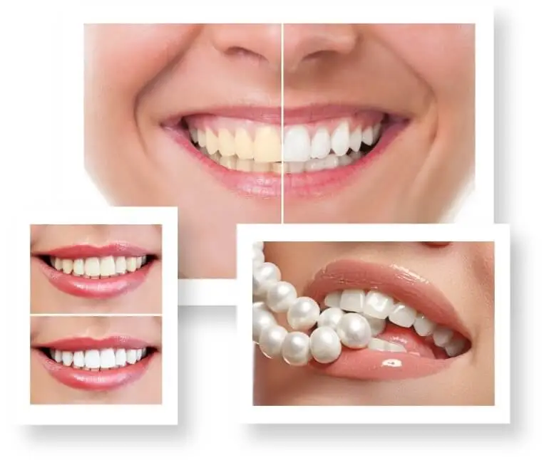 Showcase Your Smile Gallery Dentist