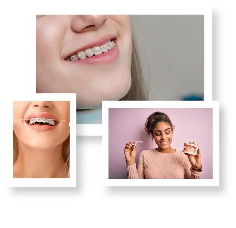 Showcase Your Smile Gallery Orthodontists